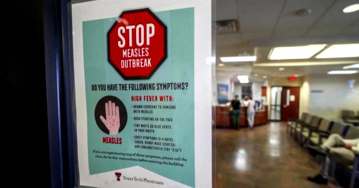 "The child is terrified": Doctors on front lines of measles comeback speak out