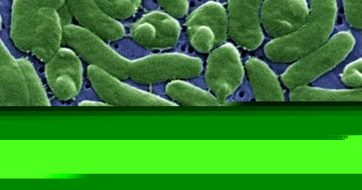 Case tracker: Here is where flesh-eating bacteria cases have been reported in the US