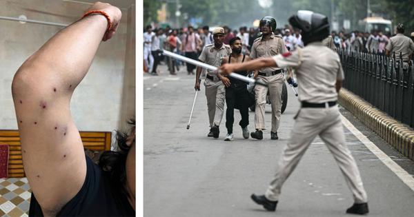 Ten persons injured by pellets during youth protest march to Parliament, shows RTI response