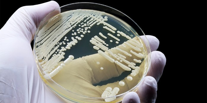 Deadly Drug Resistant Fungus Spreads In Indiana