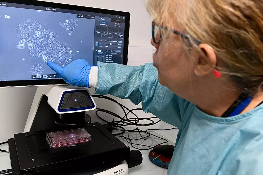 Spanish Researchers Announce Pancreatic Cancer Cure With Triple Therapy