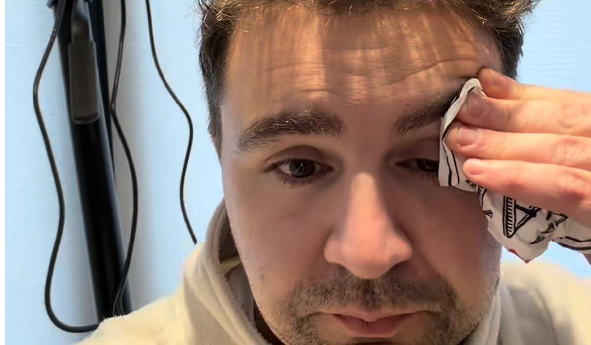 Carl Mullan shares the dangers of podcasting after suffering injury on set
