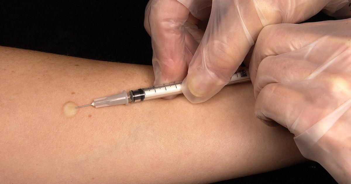 People urged by NHS to check vaccination status for Immunisation Awareness Month