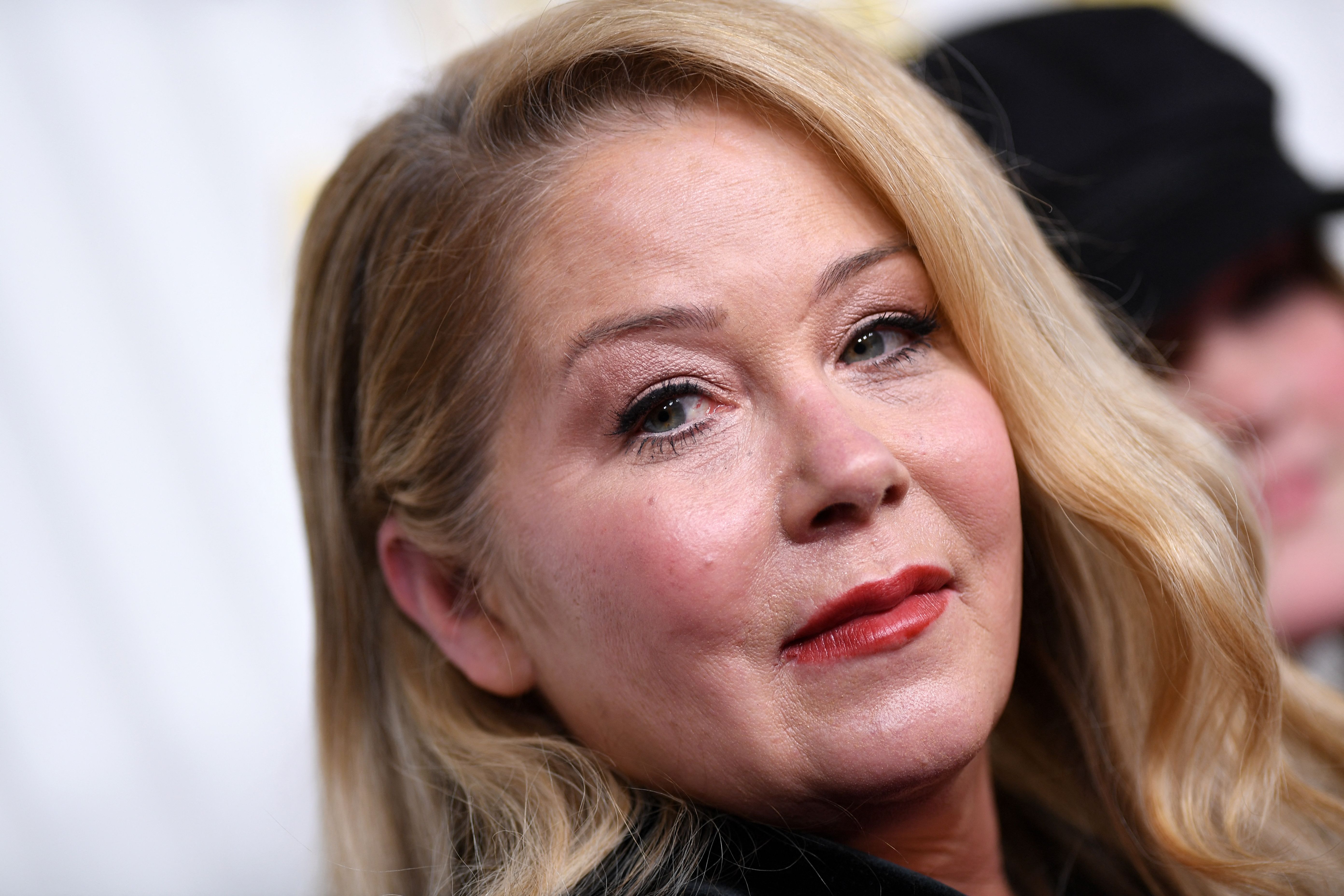 Christina Applegate’s Costar Shares Update About Her MS Battle