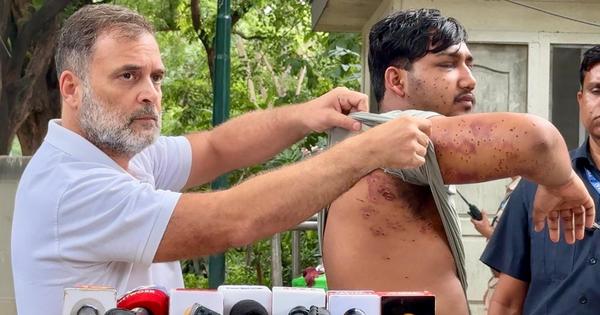 Rush Hour: Rahul Gandhi says pellet guns fired at students, HC refuses NIA probe into protest & more