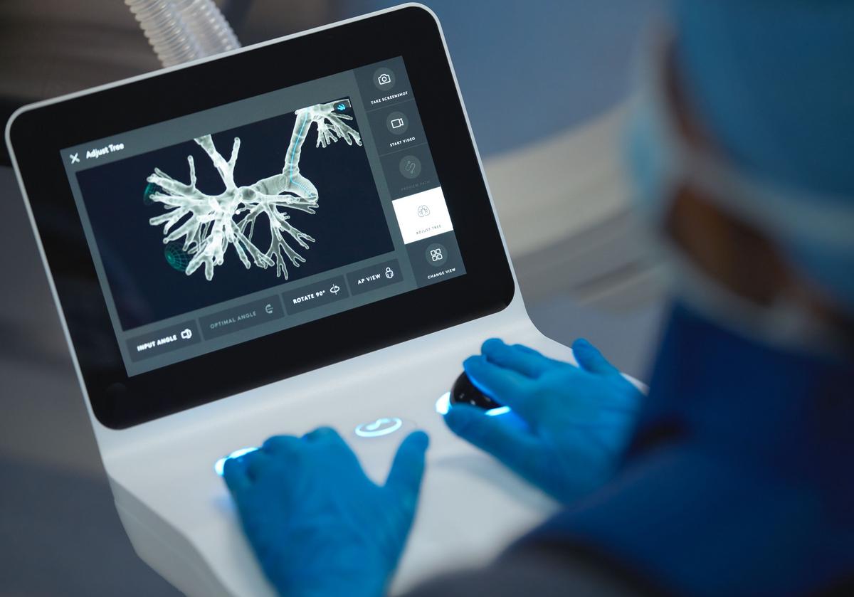 Local Hospital Launches Robotic System For Lung Cancer Care