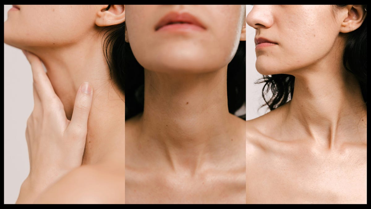 Should You Get Botox in Your Neck?