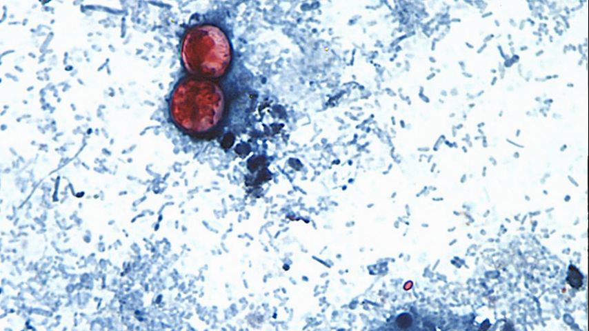 Michigan reports first 2 US deaths in outbreak of cyclospora