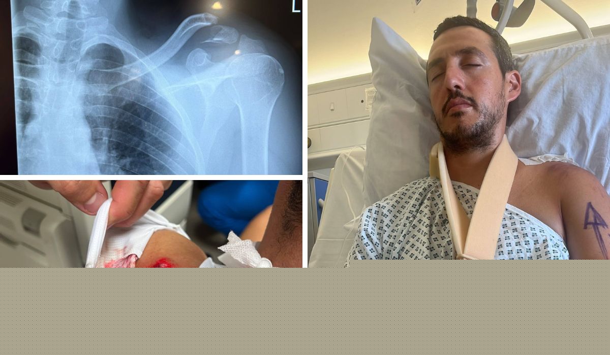 “Blajt ħofra qawwija u tirt minn fuq ir-rota” – Camilleri jitlef iċ-ċans li jikkompeti fit-Triple Ironman