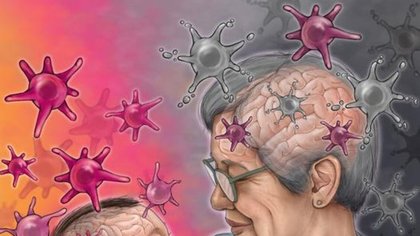 Ci sono cellule invecchiate anche nel cervello dei bambini