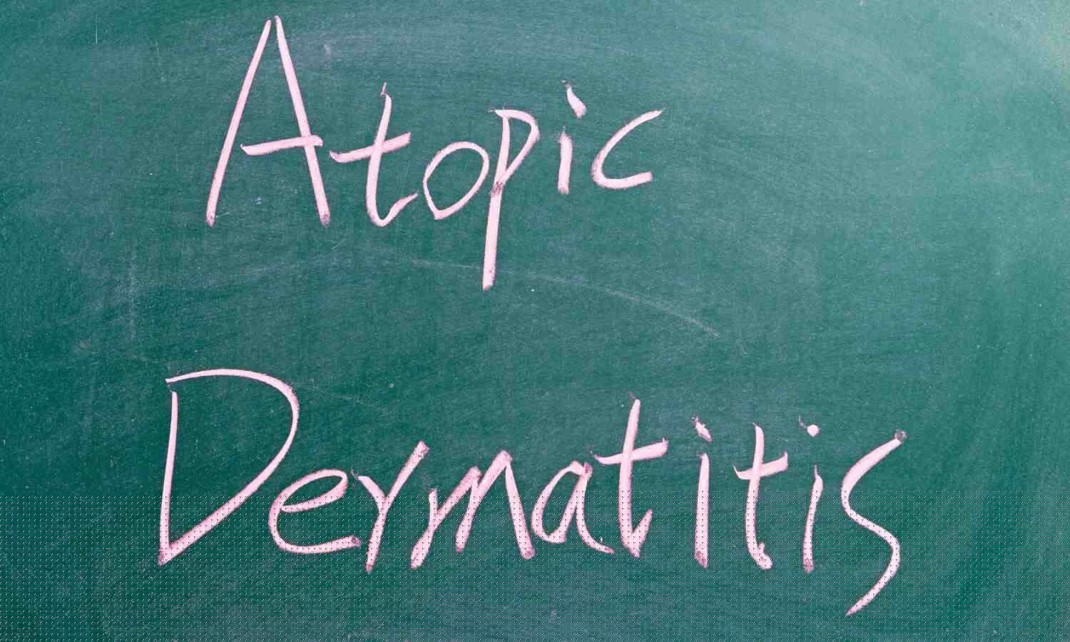 Atopic dermatitis associated with increased CKD risk in Asian population: Study