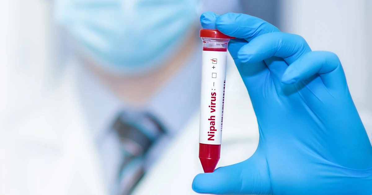 Kolejne zakażenia wirusem Nipah. To jeden z najbardziej śmiertelnych wirusów świata. Ma "potencjał pandemiczny"