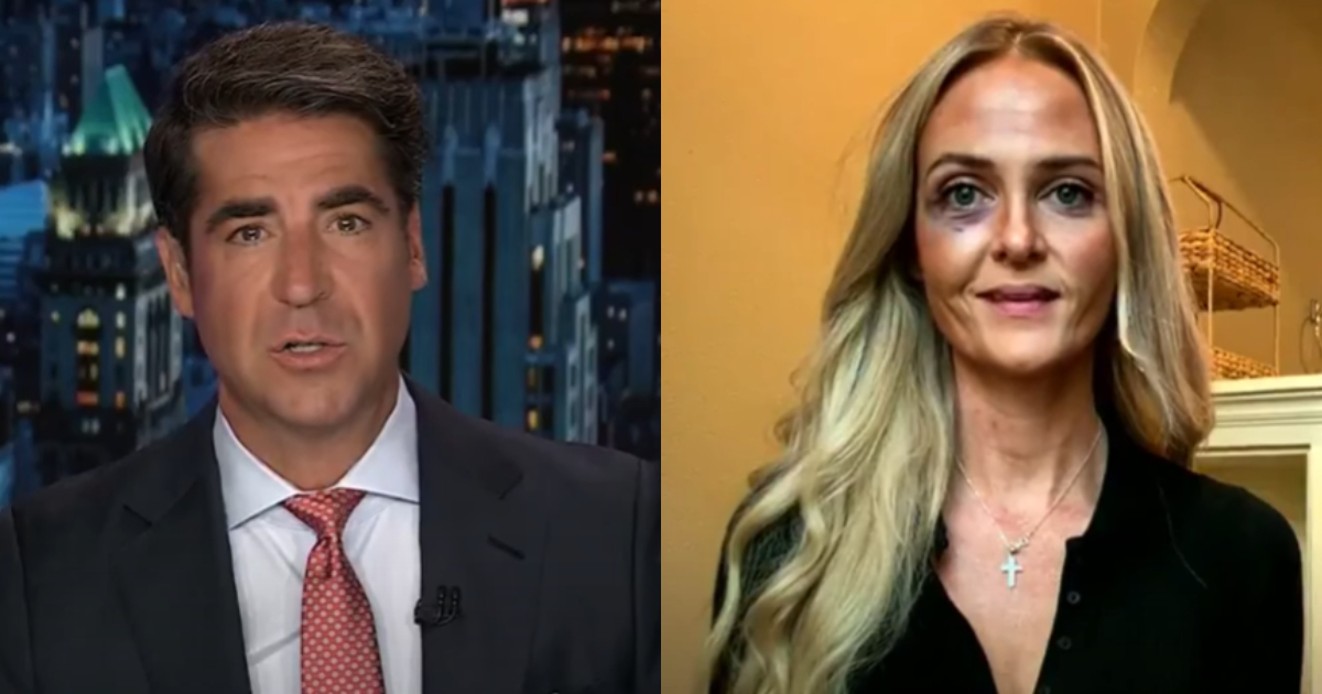 Fox News Guest Katie Daviscourt Shows Off Black Eye After Alleged Antifa Attack