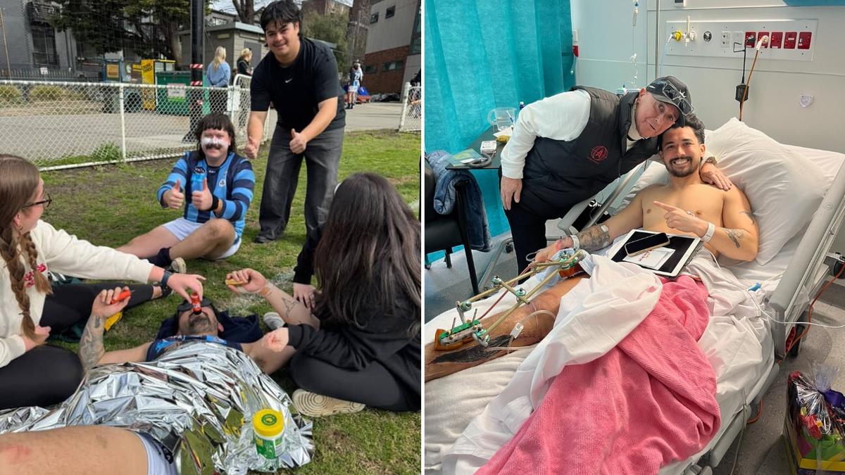 AFL content creator and reality TV star Connor Rogers felt like he ‘won Tattslotto’ after horrific leg injury
