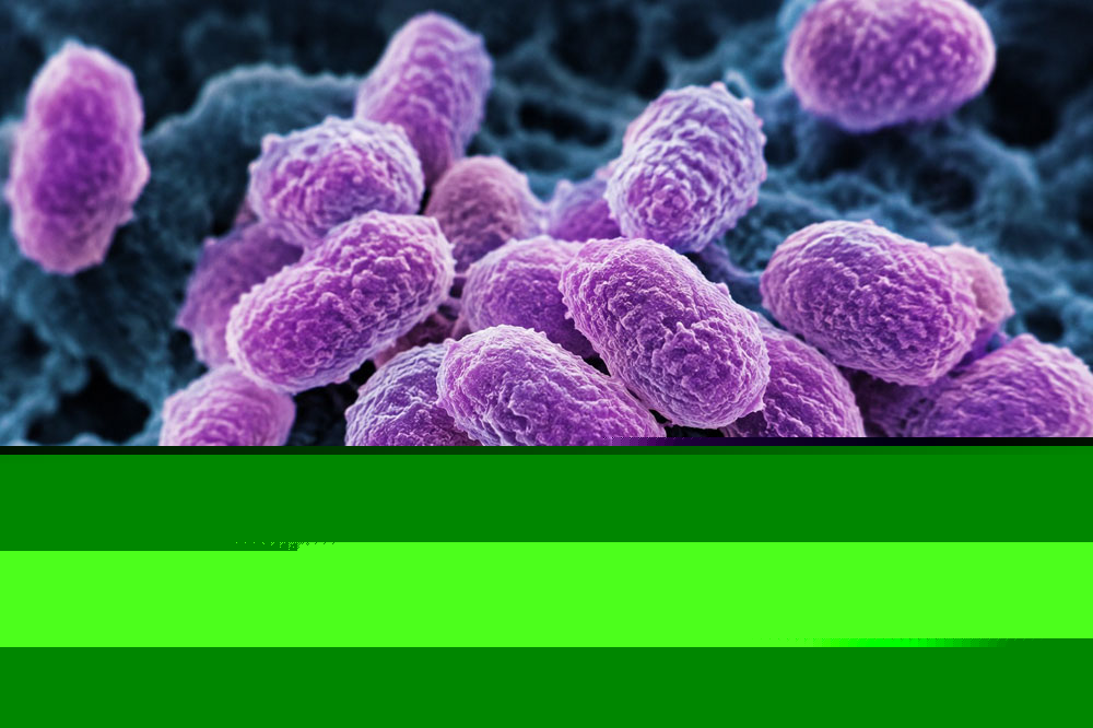 Ministry of Health monitoring drug-resistant bacteria at Milton Cato Memorial Hospital