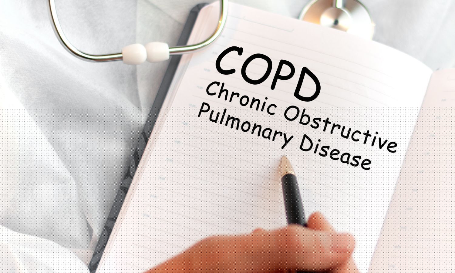 Tozorakimab Reduces COPD Exacerbations via IL-33 Blockade in Phase 3 trial