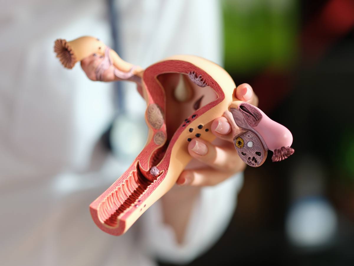 Galway experts lead project behind implant therapy for ovarian cancer