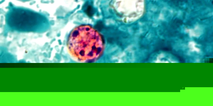 Indiana Cyclosporiasis Cases Pass 1,524, Michigan Reports First Deaths
