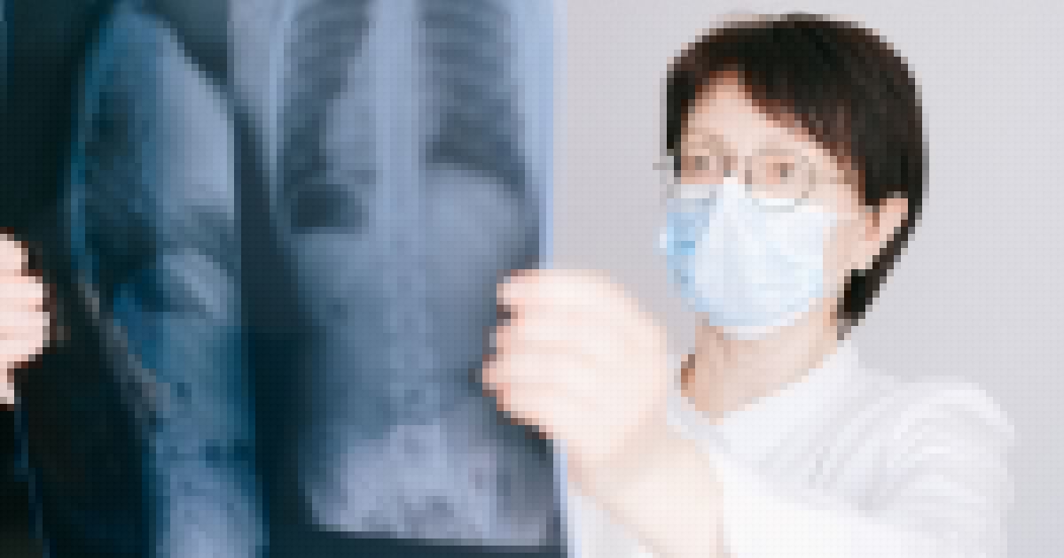 Persistent radiologist shortages are expected to drive the global teleradiology market to $66.7b by 2036.