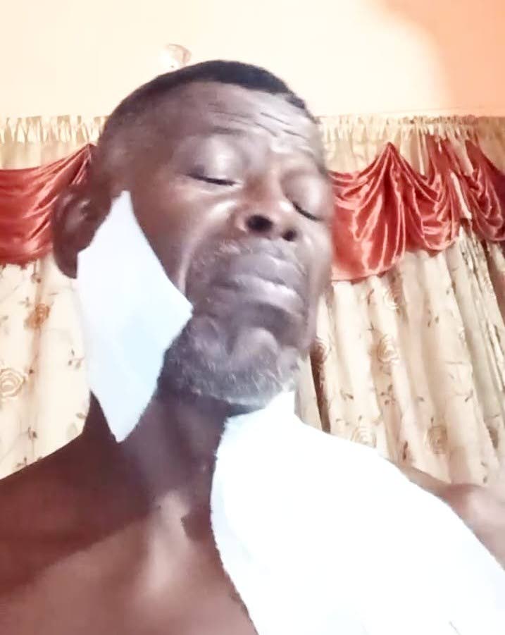 Man mauled by 7 pitbulls still seeking justice