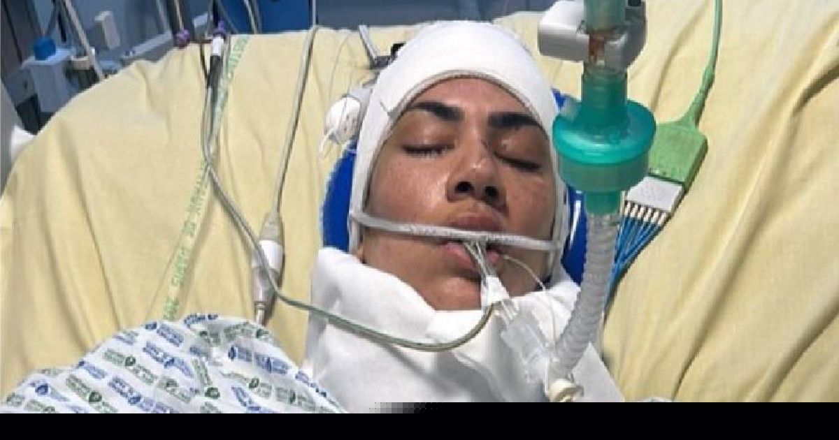 Mum falls from second floor Airbnb balcony and isn't found until next morning