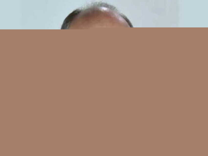 Katër drita