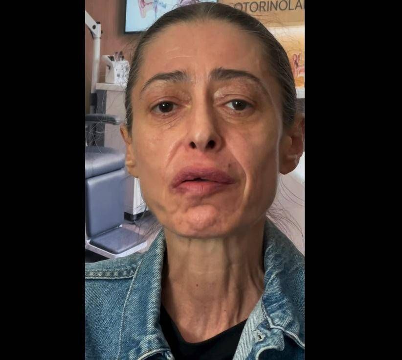 Gerardina Trovato annulla il tour: "Devo operarmi d'urgenza"
