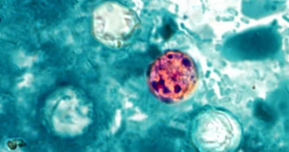 Cyclosporiasis outbreak: Florida cases up to 264; county-by-county breakdown