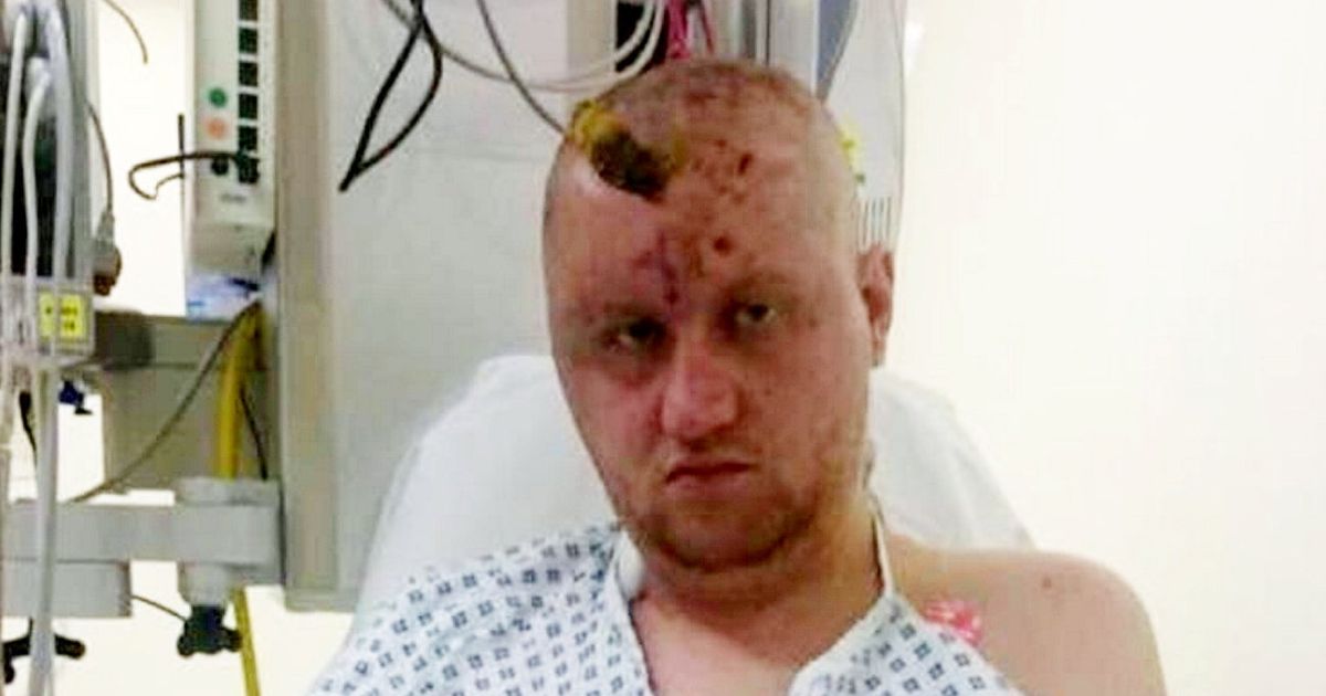 Cancer survivor suing NHS after given eight years of chemo instead of six months