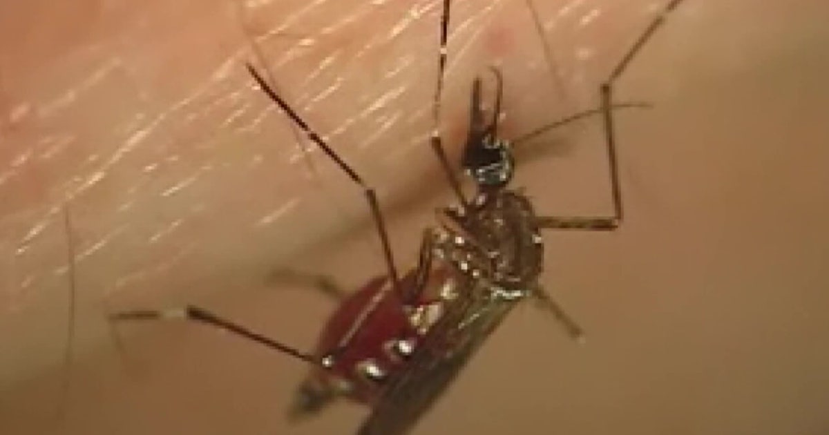 Dengue fever: 10 locally-acquired cases reported in Tampa Bay
