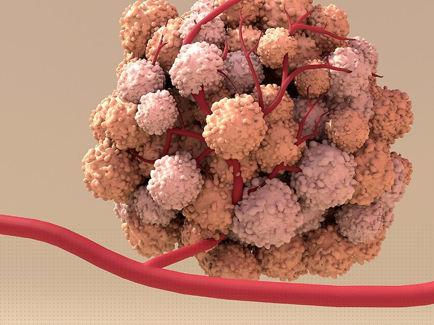 AACR D3: ONM-421 shows antigen-independent tumor control