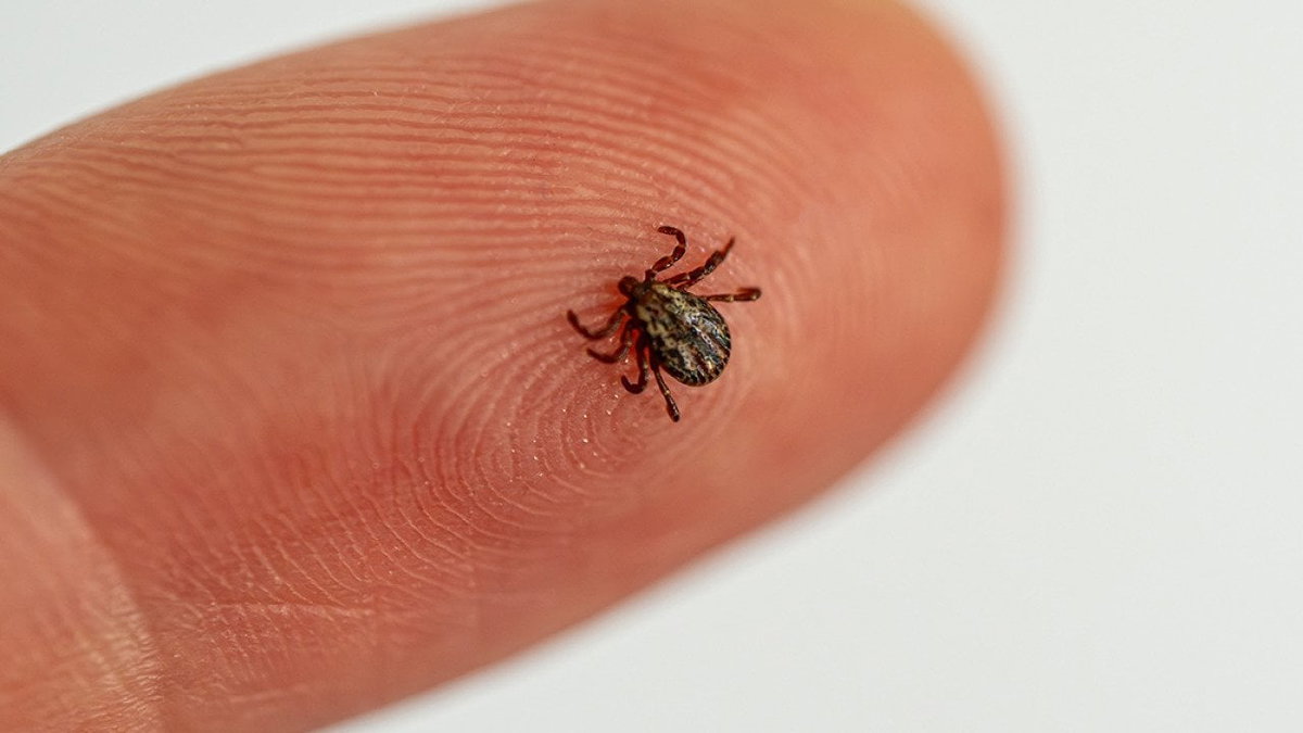 Tick bite symptoms: What to watch for in the days after a bite