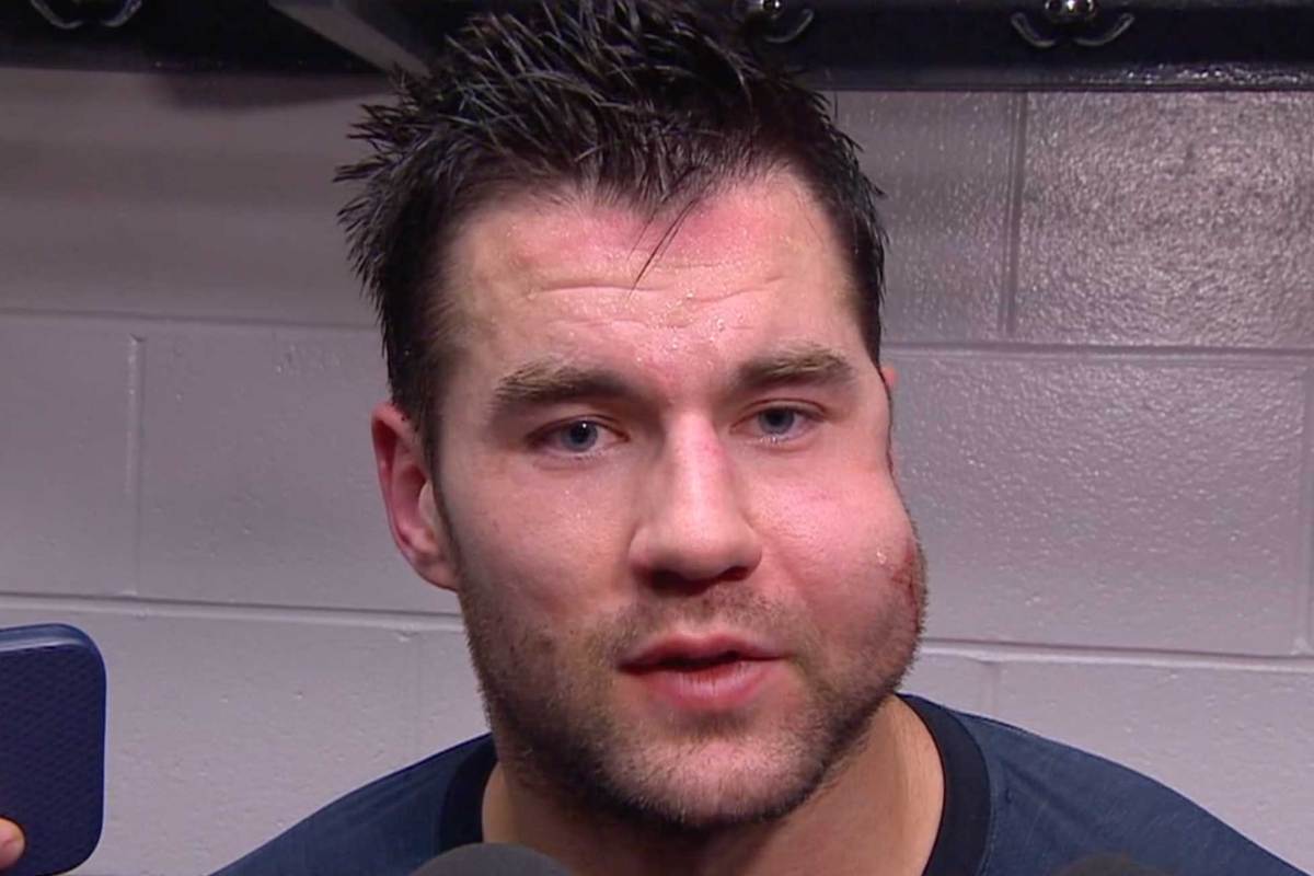 Comment on Tom Wilson, and his massively swollen face, scores twice and wins game for Capitals after taking shot off cheek: ‘It doesn’t look so hot’ by Logan Thompson’s new mask for the Capitals’ Screaming Eagle third jerseys features Tom Wilson’s massively swollen face on the back plate | RMNB