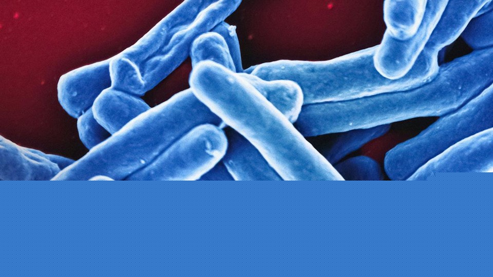 Simple blood test could aid in global TB fight