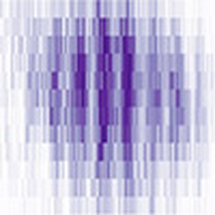 Direct imaging captures the crystalline vibrations of a supersolid made of atoms and light