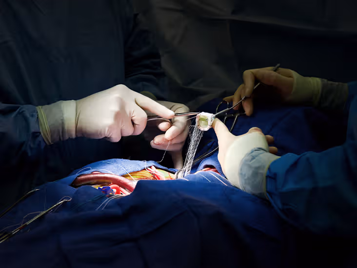 Study Indicate Need for Improved Risk Assessment Tools in Cardiac Surgery Patients