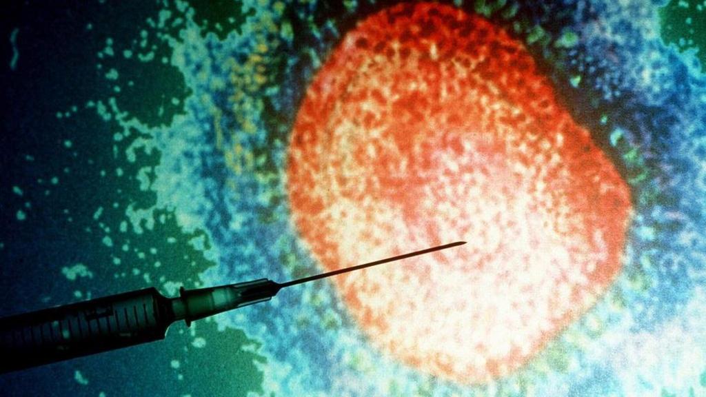 ‘Increased risk’: Urgent measles alert issued for Sydney after new case detected in returned international traveller