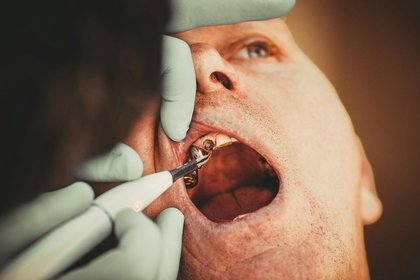 The Texas Dental Report Card Isn’t Pretty