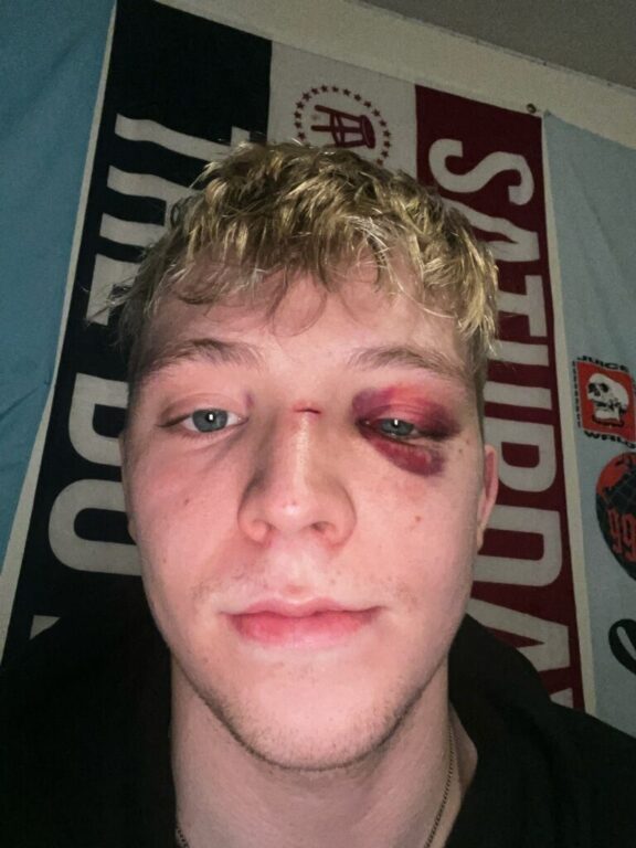 Comment on Attorney representing student allegedly punched by UI football player calls for action by Ed Maher
