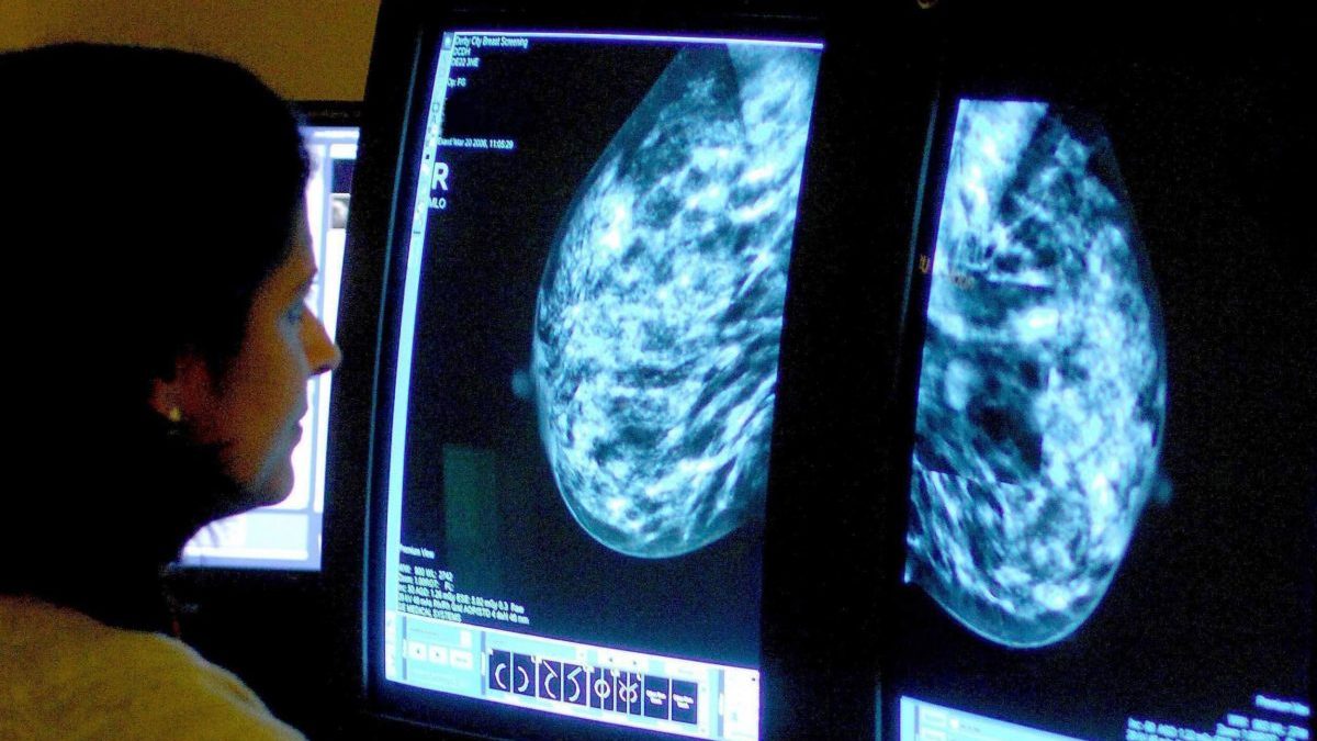 Fast-track cancer screenings at GPs and food banks