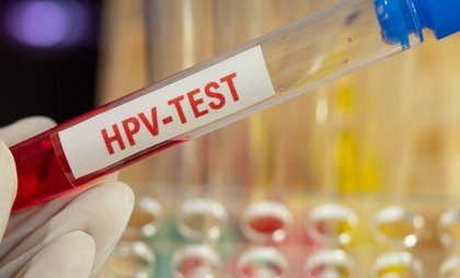 New Guidance Supports HPV Self-Sampling for Cervical Screening