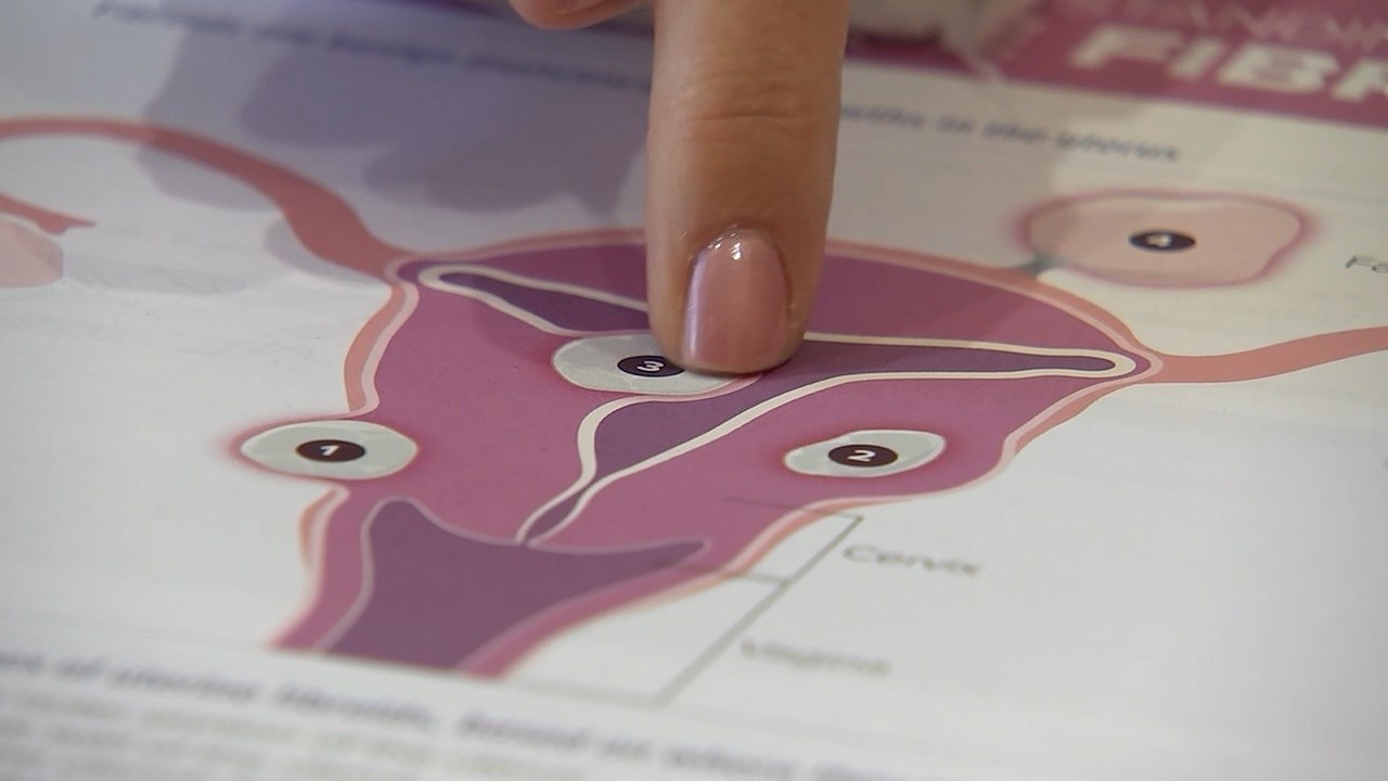 Holy Name Fibroid Center