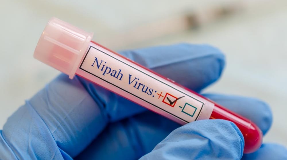 Nipah Outbreak Risk in Pakistan Remains Low: NIH
