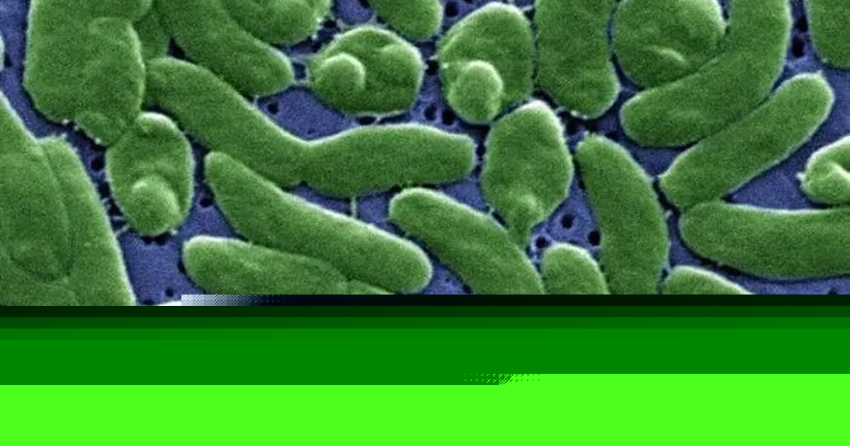 Case tracker: Here is where flesh-eating bacteria cases have been reported in the US