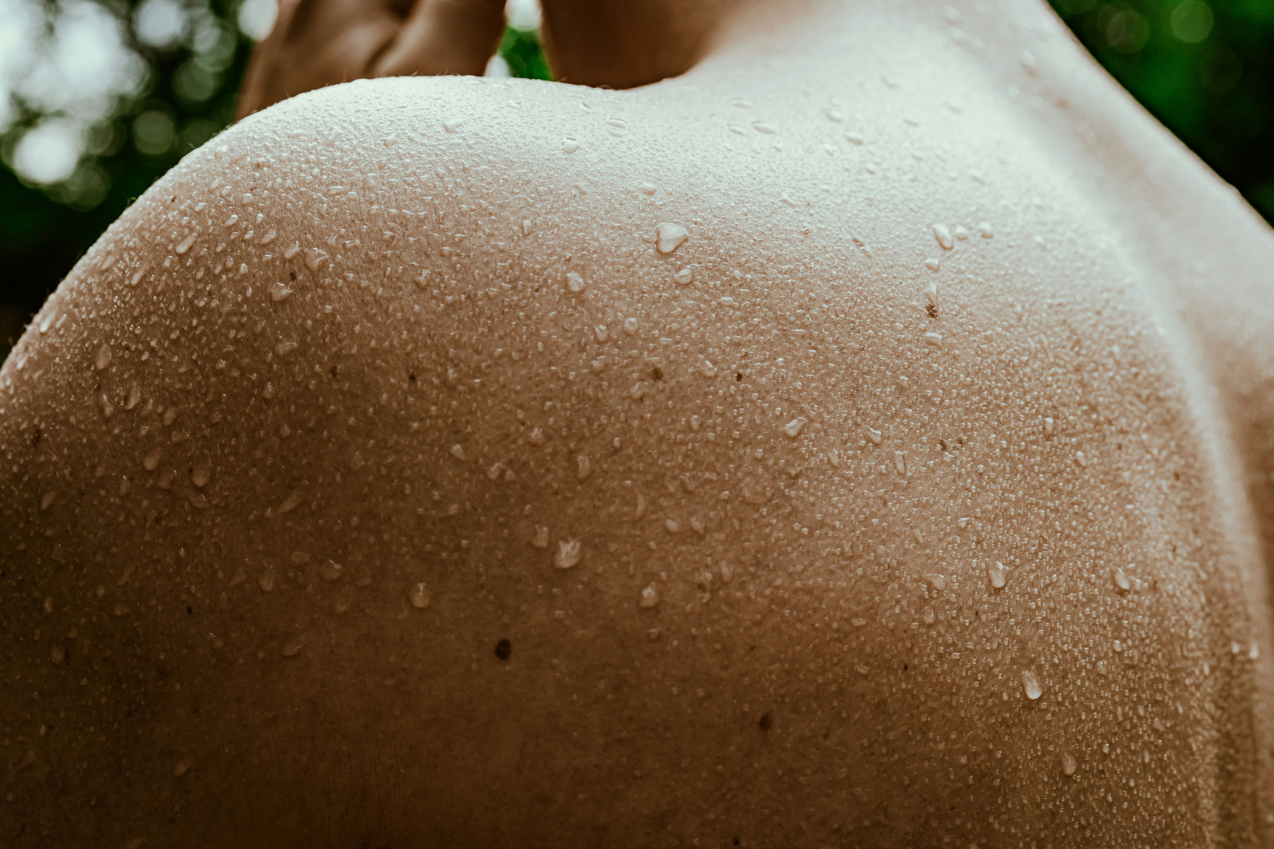 Excessive Sweating Without Exercise: Hidden Medical Causes You Shouldn't Ignore