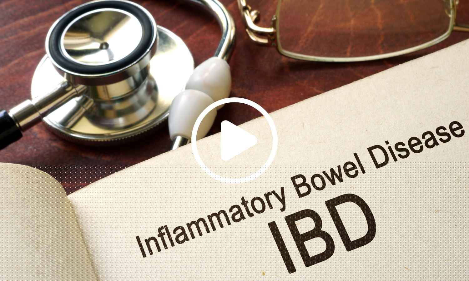 Inflammatory Bowel Disease Linked to Higher Risk of Psychiatric Disorders: Study