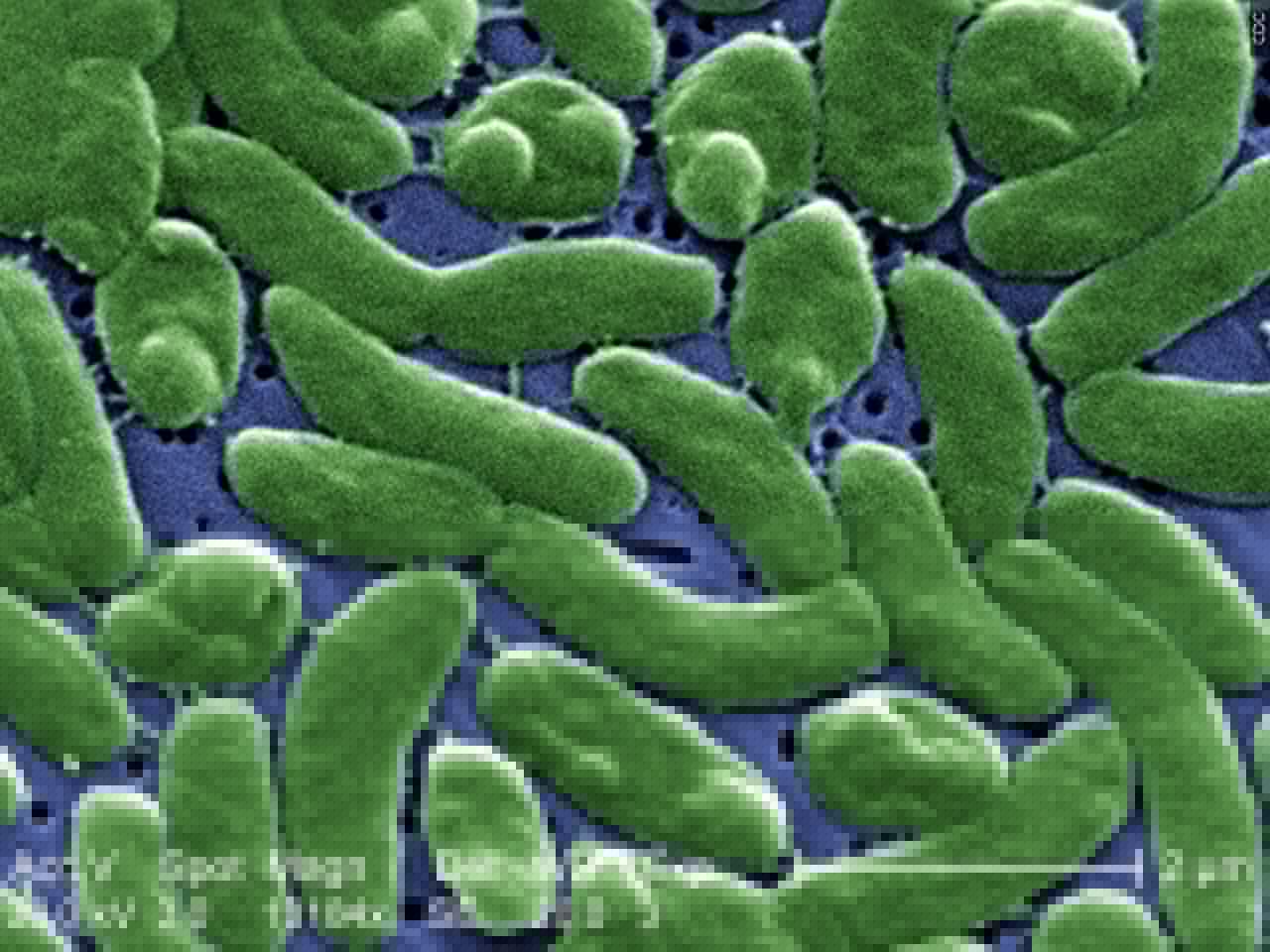 Flesh-eating bacteria kill at least 7 along Gulf Coast. Here’s how to protect yourself.