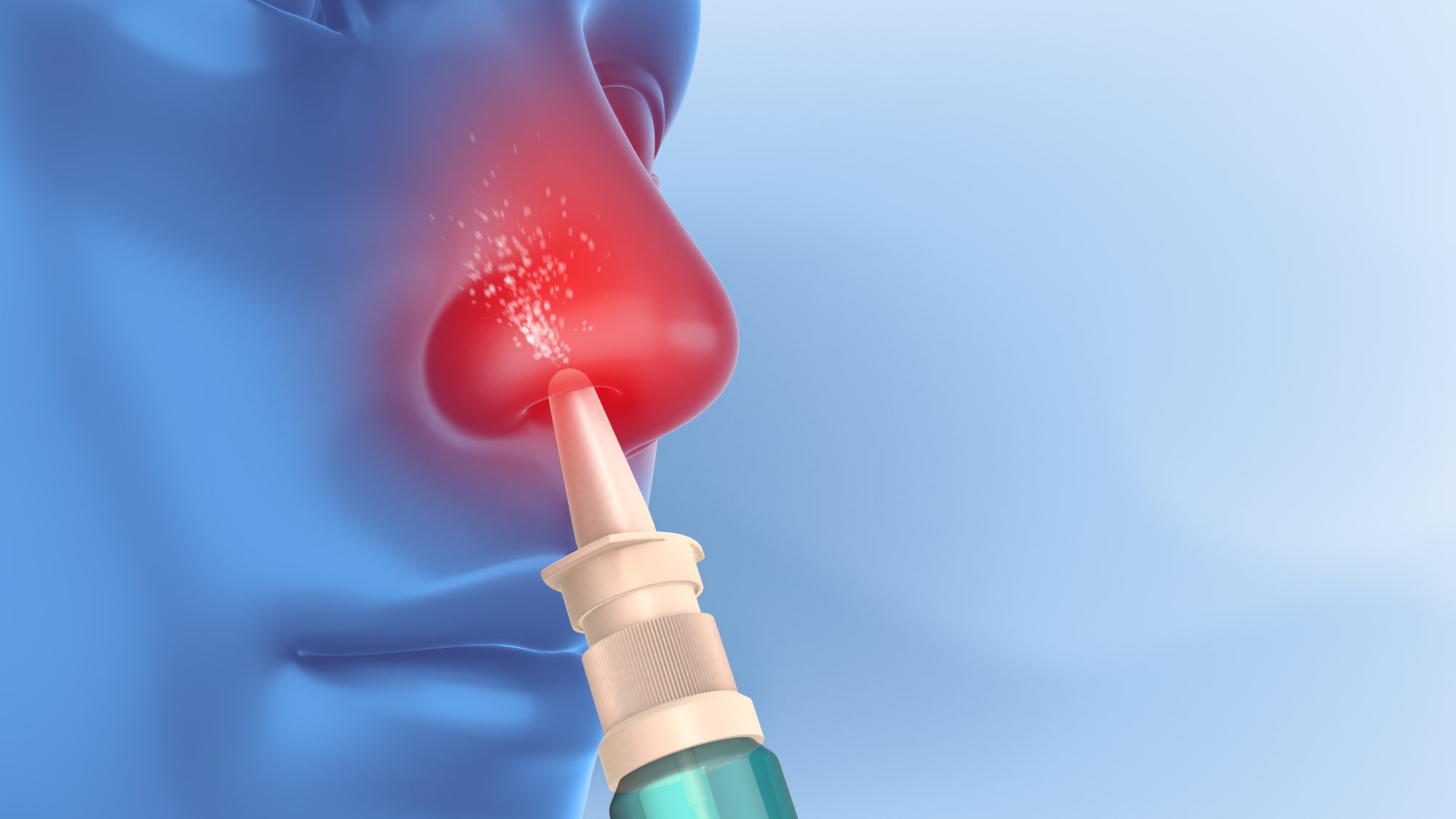 Could nasal sprays replace needles for adrenaline delivery in anaphylaxis