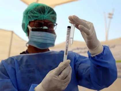 Overall risk of Nipah outbreak in Pakistan remains low, NIH informs high-level meeting