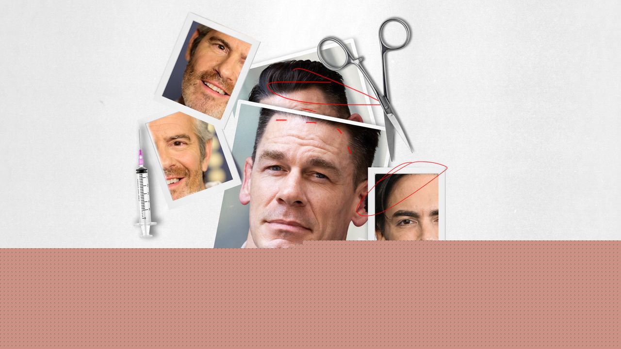 Famous Men Want You to Know What Work They’ve Had Done